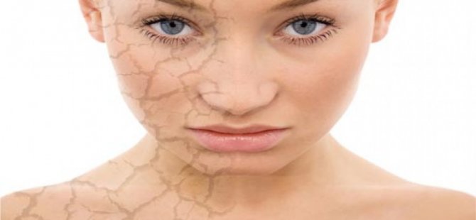 Cildinizden Yılların İzlerini Dolgu İle Silmek Mümkün